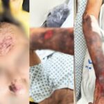 Suspeito de torturar e tentar matar idoso em Brusque é preso em Florianópolis ​Florianópolis